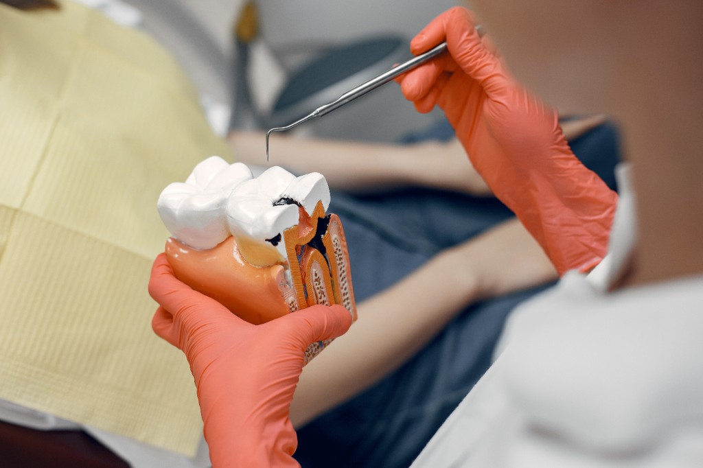 Root canal treatment demonstration at Dentaura